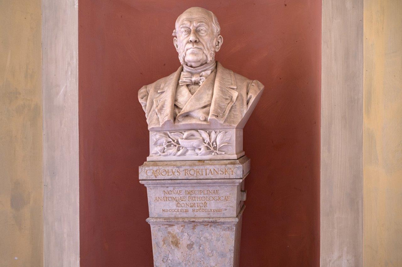 Büste von Rokitansky