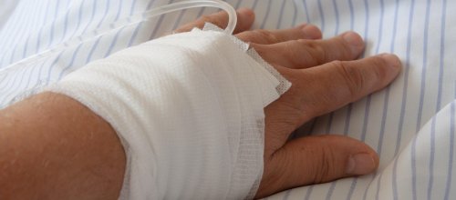 Man sieht eine linke Hand, die mit einem Verband versehen ist, aus dem ein Infusionsschlauch herausragt.