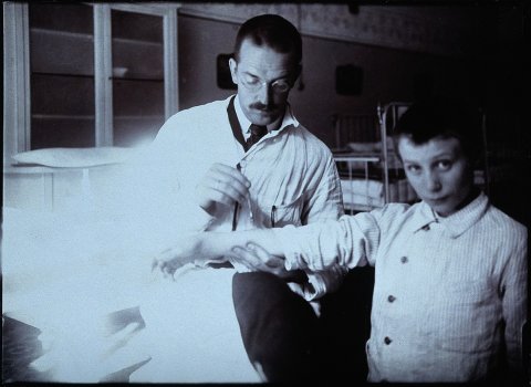 Pirquet mit patient