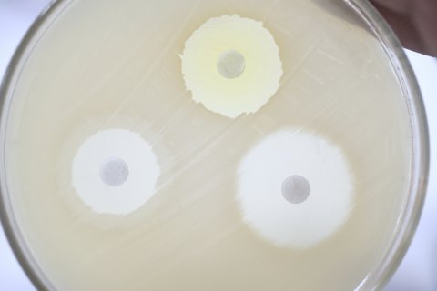 Antibiotika-Sensitivitätstest